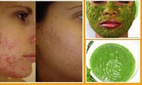 Neem an amazing product for beautiful Face & Hair